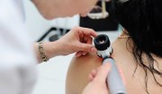 Wer die Diagnose “heller Hautkrebs” erhält, sollte seinen Arzt oder seine Ärztin auch über die eigene Berufstätigkeit informieren. Darauf weist die Deutsche Gesetzliche Unfallversicherung (DGUV) hin.